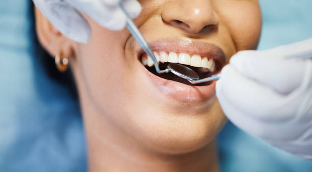 Best Emergency Broken Tooth Repair in Owings, MD